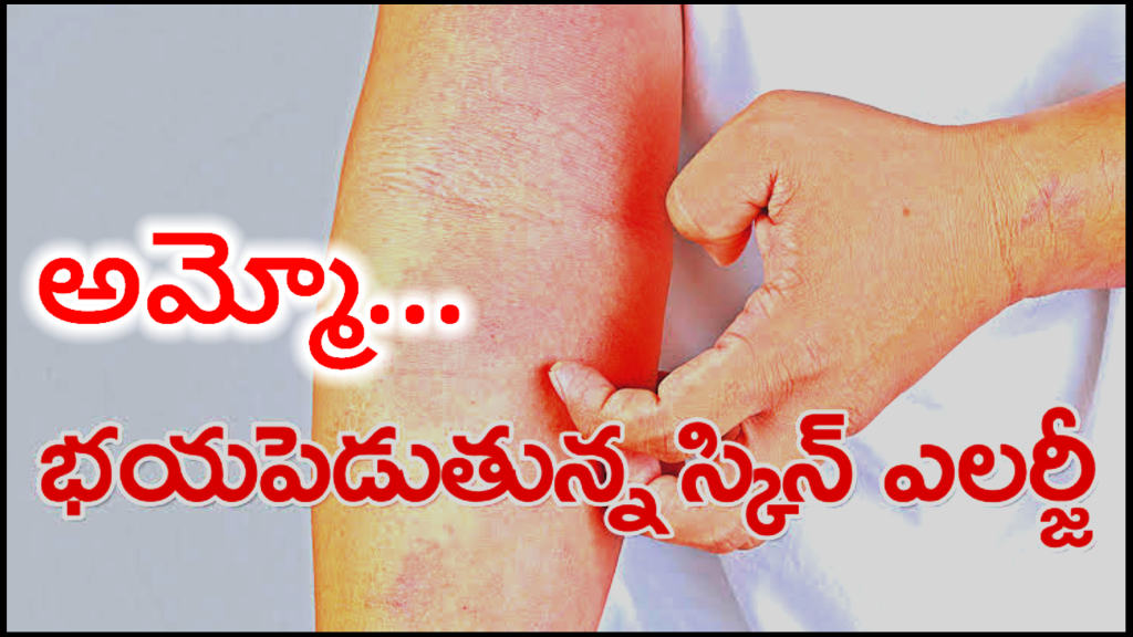 Skin Allergy Tips Telugu - ఈ సలహాలు పాటిస్తే చాలు ఎలాంటి ఎలర్జీ ఐన తగ్గుతుంది