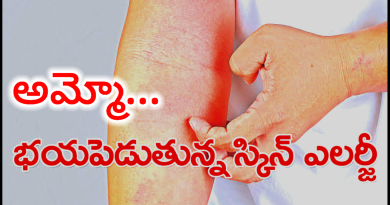 Skin Allergy Tips Telugu - ఈ సలహాలు పాటిస్తే చాలు ఎలాంటి ఎలర్జీ ఐన తగ్గుతుంది.